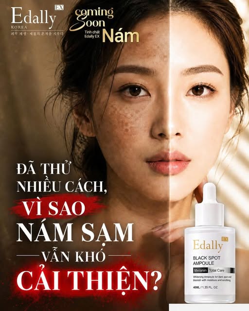 ĐÃ THỬ NHIỀU CÁCH NHƯNG NÁM SẠM VẪN CỨ “Ở LÌ” – VÌ SAO?